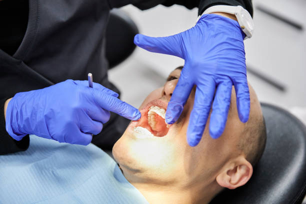 Best Emergency Treatment for Dental Infections or Abscesses in Rio Grande City, TX